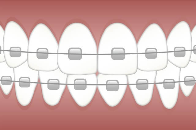 orthodontist in zuerich picture